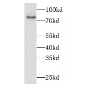 WB analysis of PC-3 cells, using DPP8 antibody (1/300 dilution).