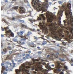 Dipeptidyl Peptidase 9 (DPP9) Antibody
