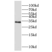 WB analysis of MCF7 cells, using DPPA2 antibody (1/500 dilution).