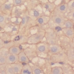 Dihydropyrimidinase (DPYS) Antibody