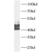 WB analysis of HeLa cells, using DR4 antibody (1/1000 dilution).