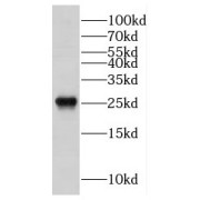 WB analysis of mouse kidney tissue, using DRAP1 antibody (1/300 dilution).