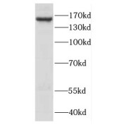 WB analysis of mouse skin tissue, using DSG4 antibody (1/600 dilution).