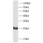 WB analysis of human brain tissue, using DTD1 antibody (1/500 dilution).