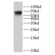 WB analysis of mouse skeletal muscle tissue, using DTNB antibody (1/300 dilution).