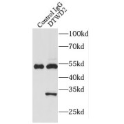 IP analysis of COLO 320 cell lysate (2000 µg), using DTWD2 antibody (3 µg, detection: 1/300 dilution).