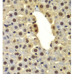 Probable E3 Ubiquitin-Protein Ligase DTX2 (DTX2) Antibody