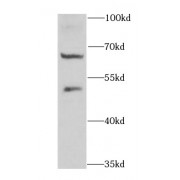 WB analysis of mouse lung tissue, using DTX2 antibody (1/1000 dilution).