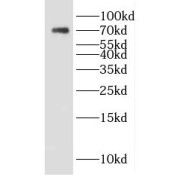 WB analysis of mouse kidney tissue, using DTX4 antibody (1/300 dilution).