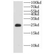 WB analysis of HeLa cells, using DTYMK antibody (1/500 dilution).