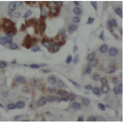 Dual Specificity Phosphatase 19 (DUSP19) Antibody