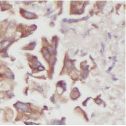 Dual Specificity Phosphatase 22 (DUSP22) Antibody