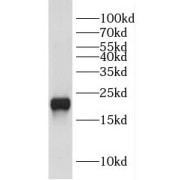 WB analysis of Transfected HEK-293 cells, using DUSP22 antibody (1/1000 dilution).