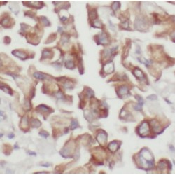 Dual Specificity Phosphatase 22 (DUSP22) Antibody