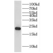 WB analysis of Transfected HEK-293 cells, using DUSP22 antibody (1/1000 dilution).