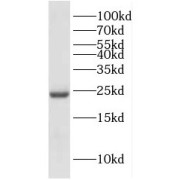 WB analysis of human liver tissue, using DUT antibody (1/800 dilution).