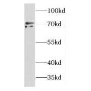 WB analysis of Jurkat cells, using DYNC1I2 antibody (1/600 dilution).