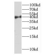 WB analysis of human liver tissue, using DYNC2LI1 antibody (1/500 dilution).