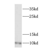 WB analysis of human heart tissue, using DYNLL2 antibody (1/400 dilution).