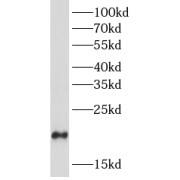 WB analysis of 293T cells, using DYNLRB1 antibody (1/1000 dilution).