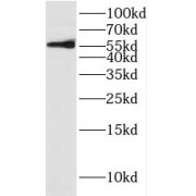 WB analysis of mouse testis tissue, using DYRK1B antibody (1/500 dilution).