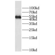 WB analysis of mouse testis tissue, using DYX1C1 antibody (1/1000 dilution).