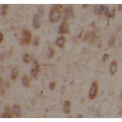 Excitatory Amino Acid Transporter 2 / EAAT2 (SLC1A2) Antibody