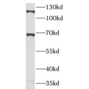 WB analysis of SW480 cells, using SLC1A2 antibody (1/1000 dilution).