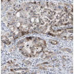 Enoyl Coenzyme A Hydratase 1, Peroxisomal (ECH1) Antibody