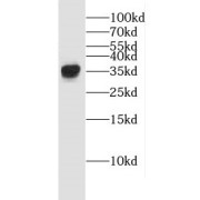 WB analysis of mouse liver tissue, using ECH1 antibody (1/500 dilution).