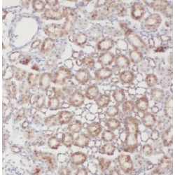 Enhancer of mRNA-Decapping 3 (EDC3) Antibody