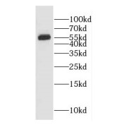 WB analysis of MCF7 cells, using EDC3 antibody (1/500 dilution).