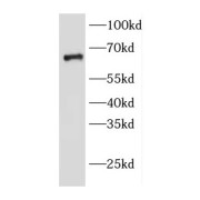 WB analysis of mouse skeletal muscle tissue, using EDEM2 antibody (1/300 dilution).