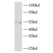 WB analysis of human lung tissue, using EDIL3 antibody (1/400 dilution).