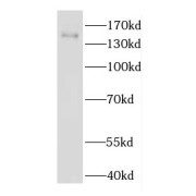 WB analysis of PC-3 cells, using EDRF1 antibody (1/1000 dilution).