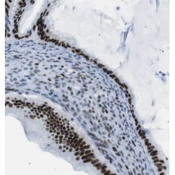 Eukaryotic Translation Elongation Factor 1 Alpha 2 (EEF1A2) Antibody