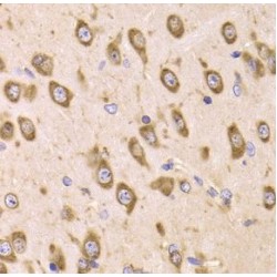 Elongation Factor 1-Beta (EEF1B2) Antibody