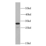 WB analysis of SKOV-3 cells, using EEF1B2 antibody (1/1000 dilution).