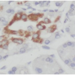 Eukaryotic Translation Elongation Factor 1 Delta (EEF1D) Antibody