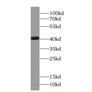 WB analysis of Jurkat cells, using EEF1D antibody (1/1000 dilution).