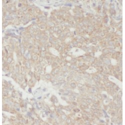 Eukaryotic Translation Elongation Factor 1 Epsilon 1 (EEF1E1) Antibody