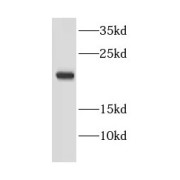 WB analysis of HepG2 cells, using EEF1E1 antibody (1/1000 dilution).