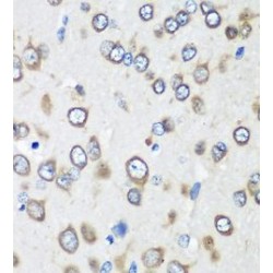 Eukaryotic Translation Elongation Factor 1 Gamma (EEF1G) Antibody