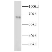 WB analysis of COLO 320 cells, using EEPD1 antibody (1/1500 dilution).