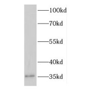 WB analysis of Transfected HEK-293 cells, using EFHD1 antibody (1/1000 dilution).