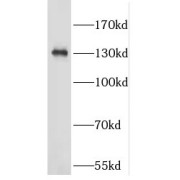 WB analysis of mouse brain tissue, using EFTUD1 antibody (1/1000 dilution).