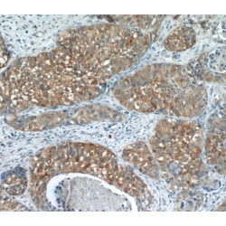 Epidermal Growth Factor Receptor (EGFR) Antibody