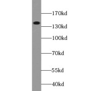 WB analysis of A431 cells, using EGFR antibody (1/1000 dilution).