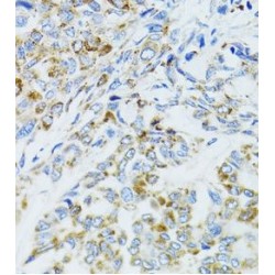 Epidermal Growth Factor Receptor (EGFR) Antibody