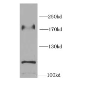 WB analysis of A431 cells, using EGFR-Specific antibody (1/1000 dilution).